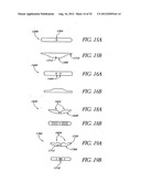 Methods of replacing a gastrointestinal bypass sleeve for therapy     adjustment diagram and image