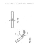 Methods of replacing a gastrointestinal bypass sleeve for therapy     adjustment diagram and image