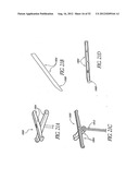 Methods of replacing a gastrointestinal bypass sleeve for therapy     adjustment diagram and image