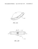 Methods of replacing a gastrointestinal bypass sleeve for therapy     adjustment diagram and image