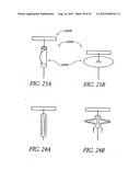 Methods of replacing a gastrointestinal bypass sleeve for therapy     adjustment diagram and image