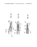 Methods of replacing a gastrointestinal bypass sleeve for therapy     adjustment diagram and image