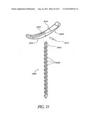 Methods of replacing a gastrointestinal bypass sleeve for therapy     adjustment diagram and image