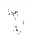 Methods of replacing a gastrointestinal bypass sleeve for therapy     adjustment diagram and image