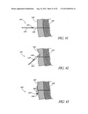 Methods of replacing a gastrointestinal bypass sleeve for therapy     adjustment diagram and image