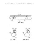 Methods of replacing a gastrointestinal bypass sleeve for therapy     adjustment diagram and image