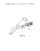 Methods of replacing a gastrointestinal bypass sleeve for therapy     adjustment diagram and image