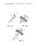 Methods of replacing a gastrointestinal bypass sleeve for therapy     adjustment diagram and image