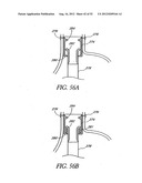 Methods of replacing a gastrointestinal bypass sleeve for therapy     adjustment diagram and image