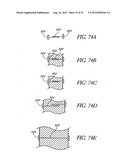 Methods of replacing a gastrointestinal bypass sleeve for therapy     adjustment diagram and image