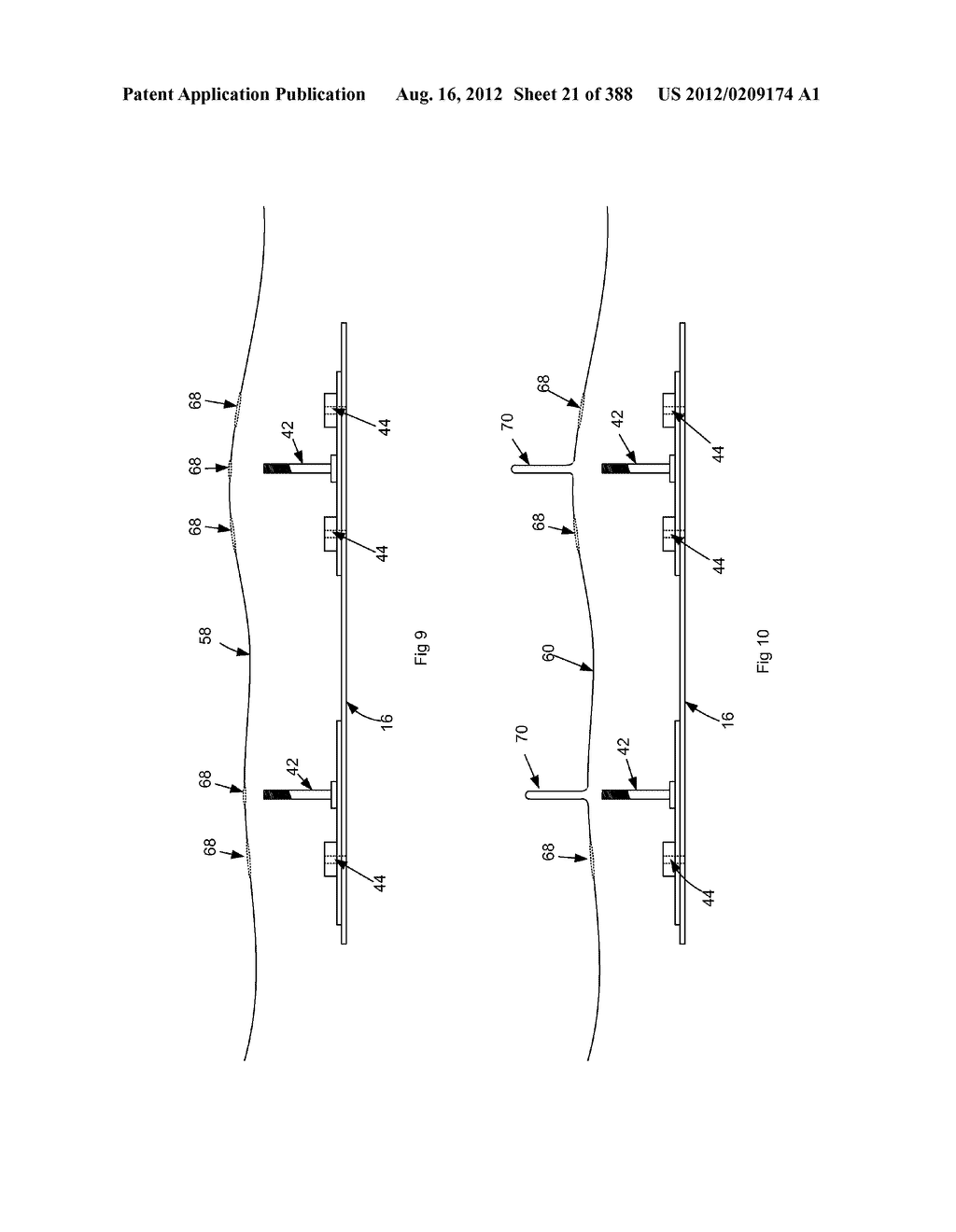 Robotic catheter system and methods - diagram, schematic, and image 22