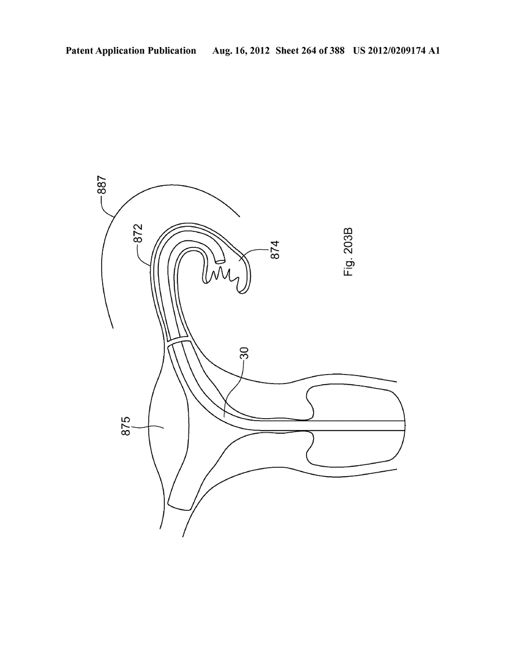 Robotic catheter system and methods - diagram, schematic, and image 265