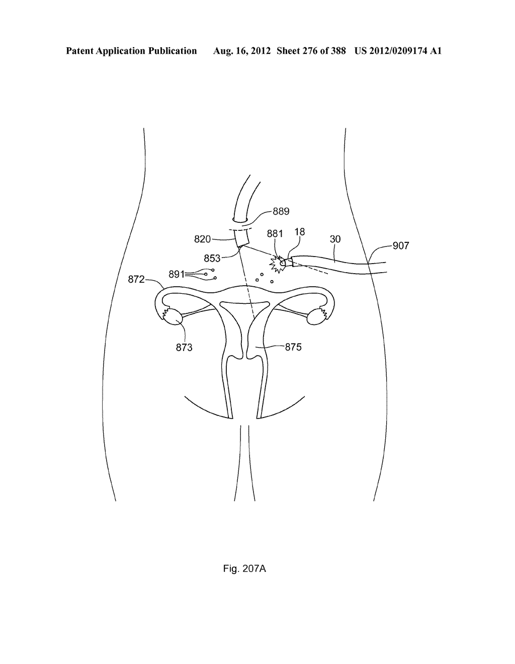 Robotic catheter system and methods - diagram, schematic, and image 277