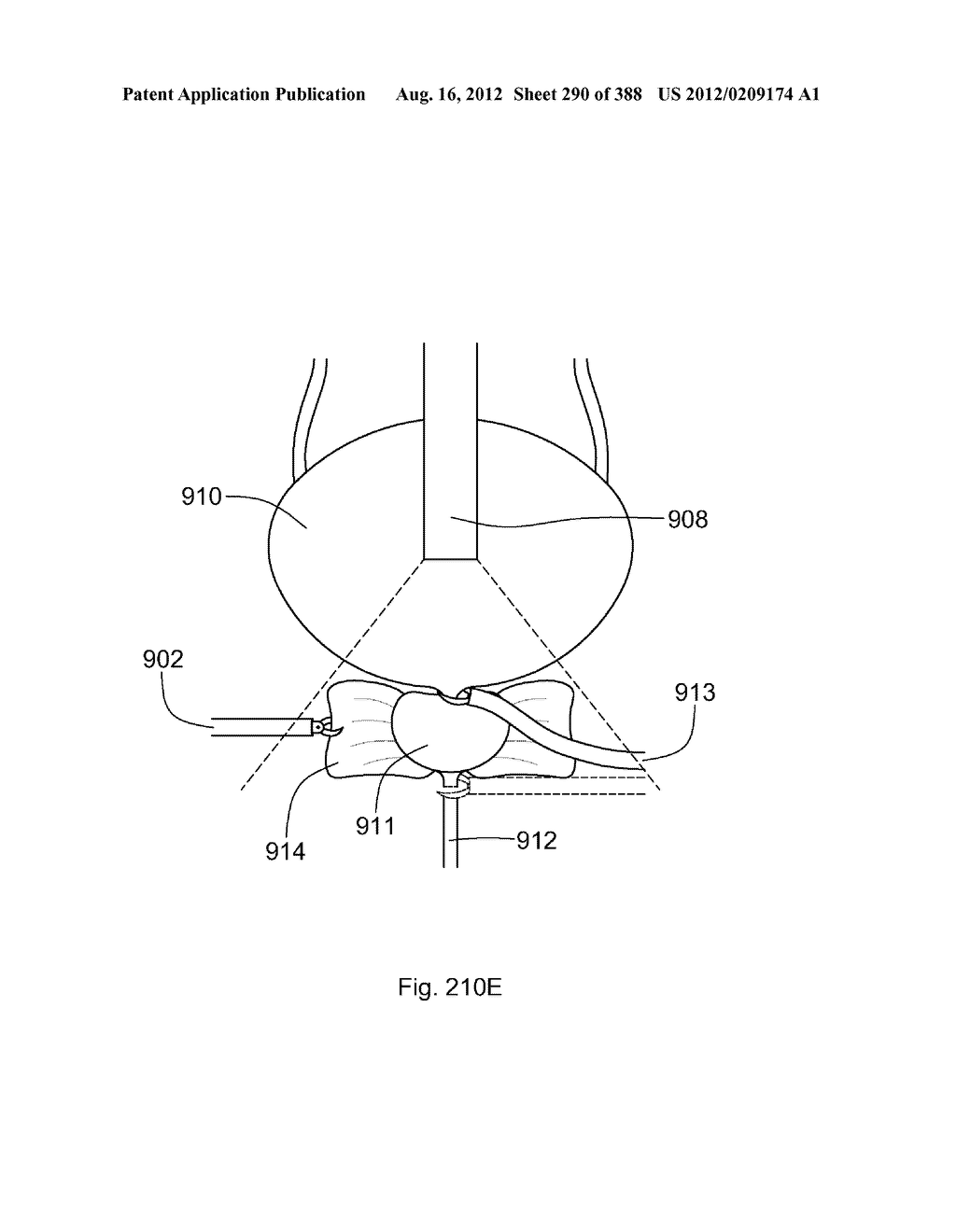 Robotic catheter system and methods - diagram, schematic, and image 291