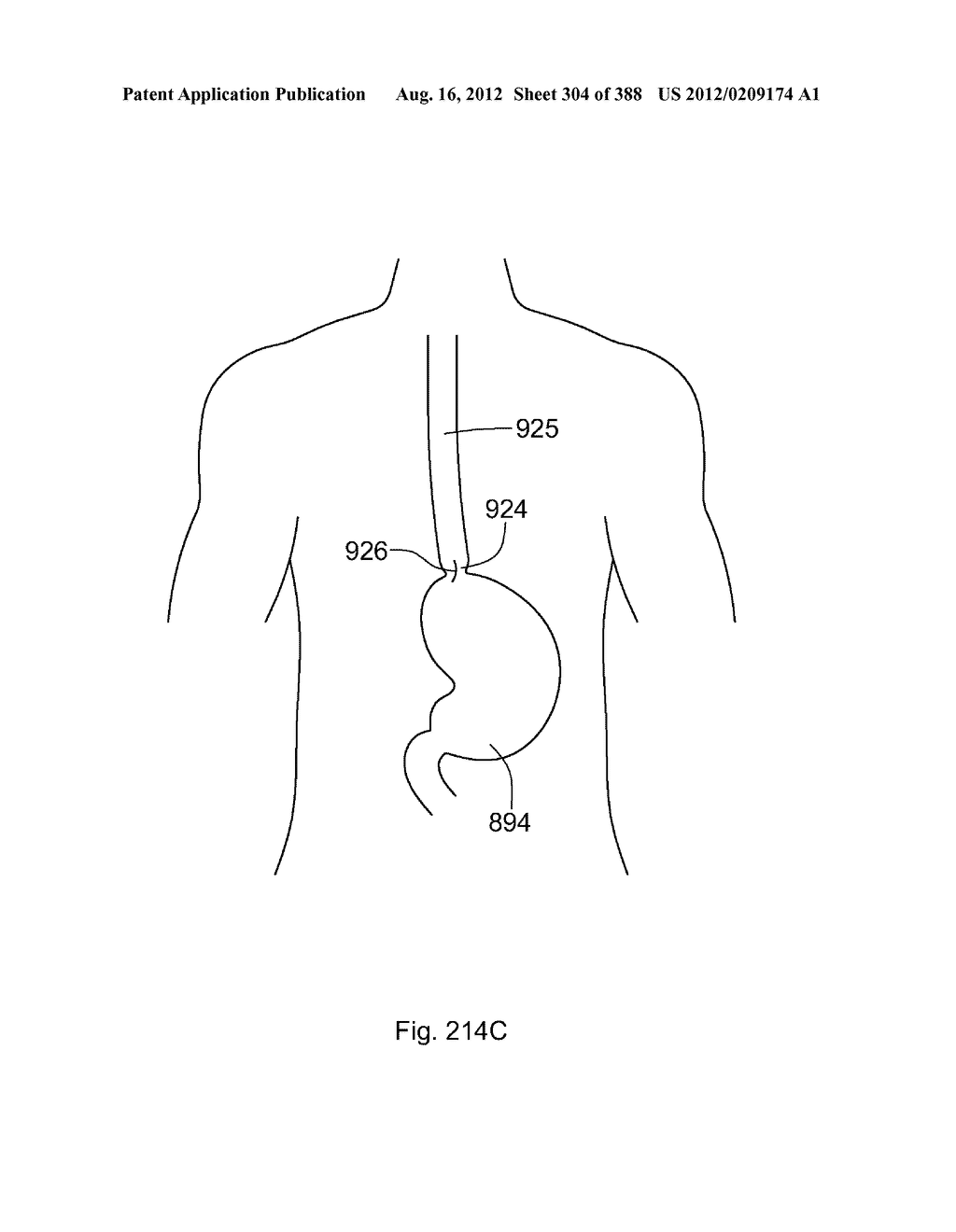 Robotic catheter system and methods - diagram, schematic, and image 305