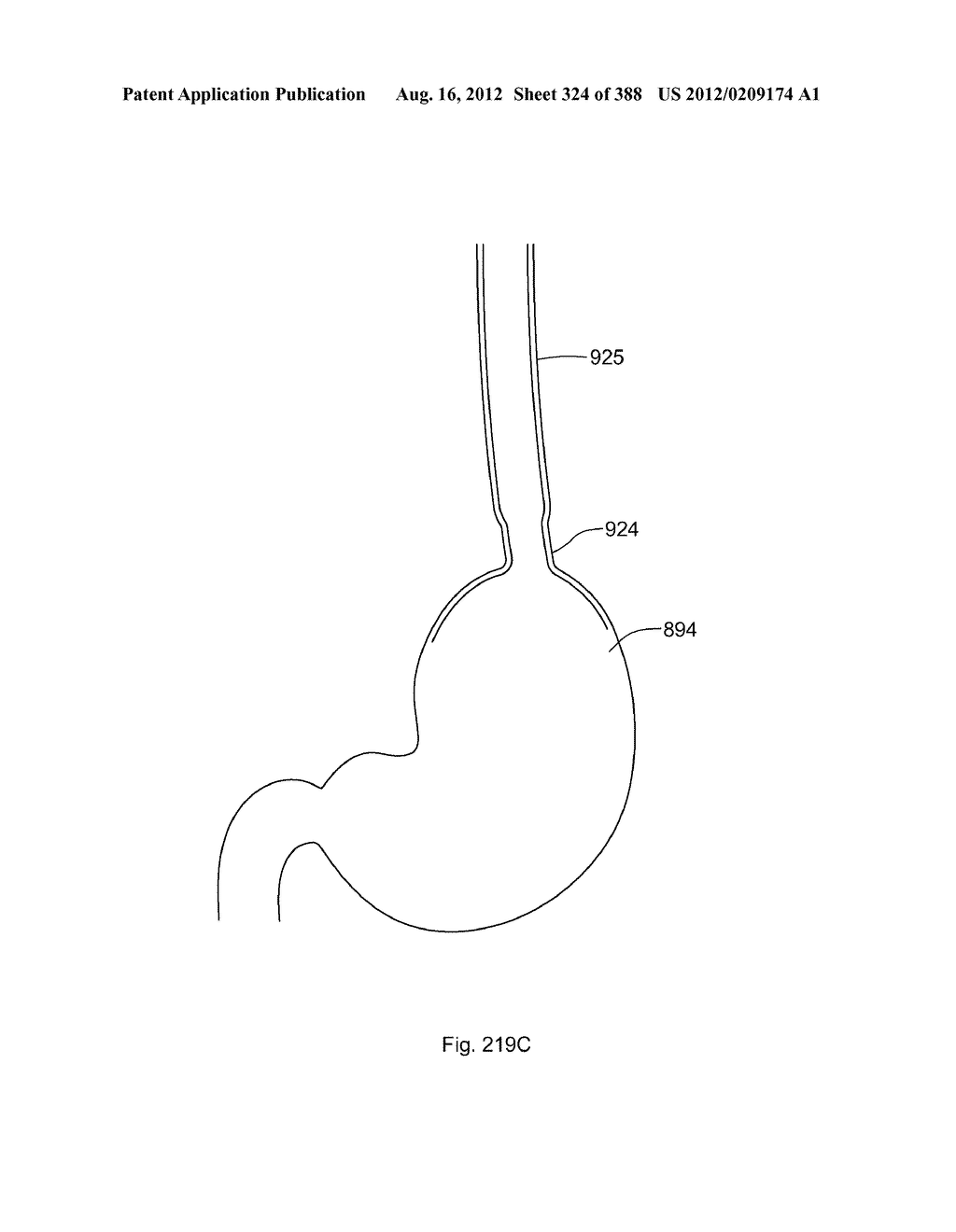 Robotic catheter system and methods - diagram, schematic, and image 325