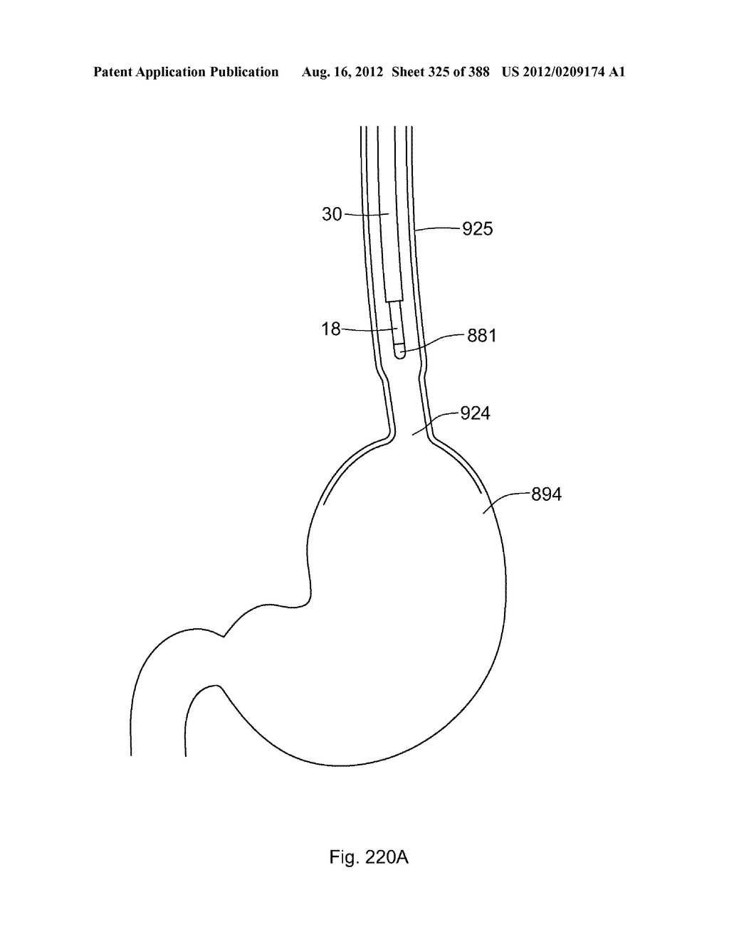 Robotic catheter system and methods - diagram, schematic, and image 326