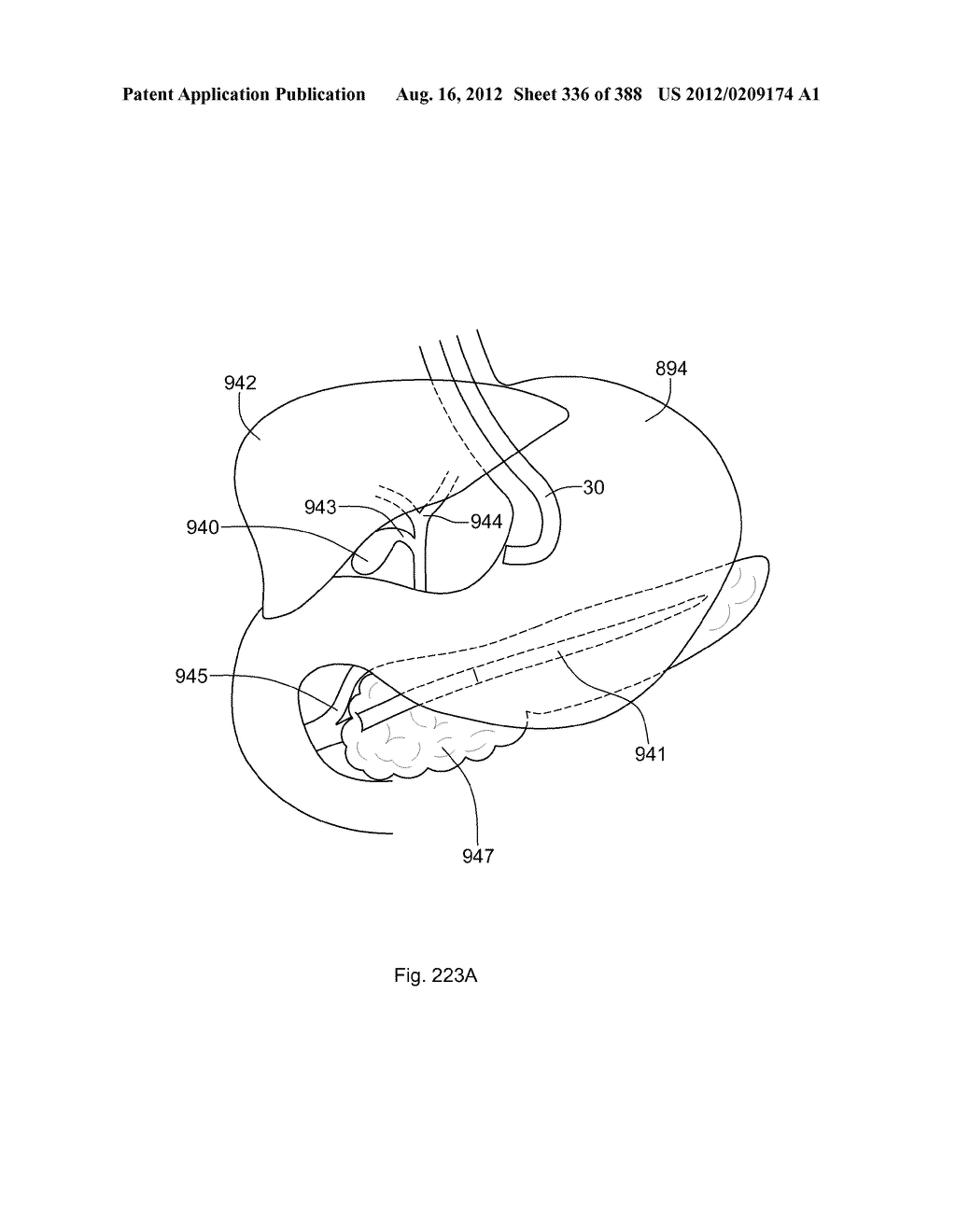 Robotic catheter system and methods - diagram, schematic, and image 337