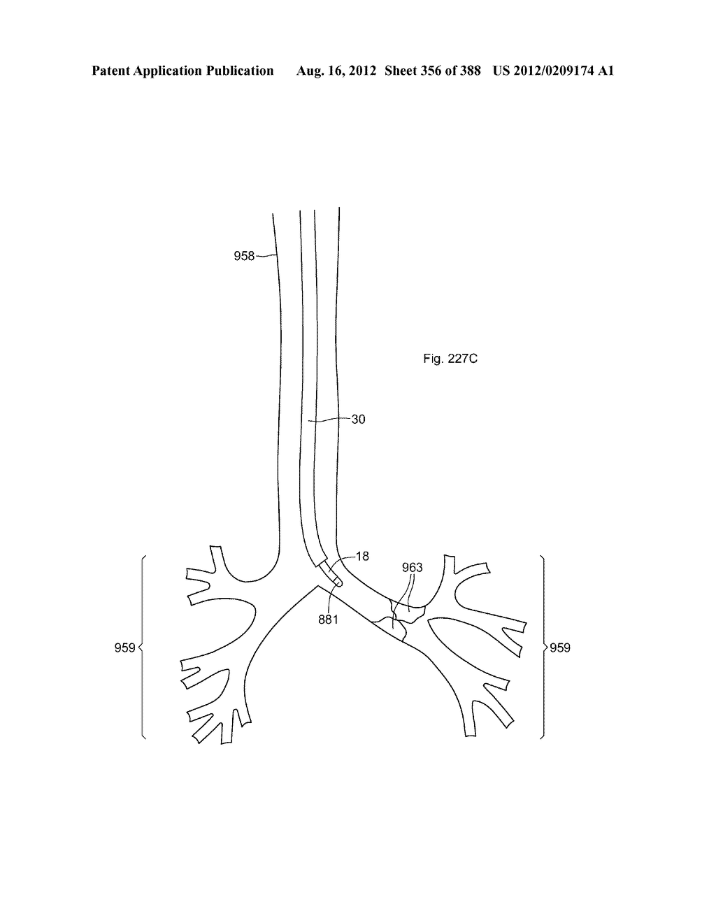 Robotic catheter system and methods - diagram, schematic, and image 357