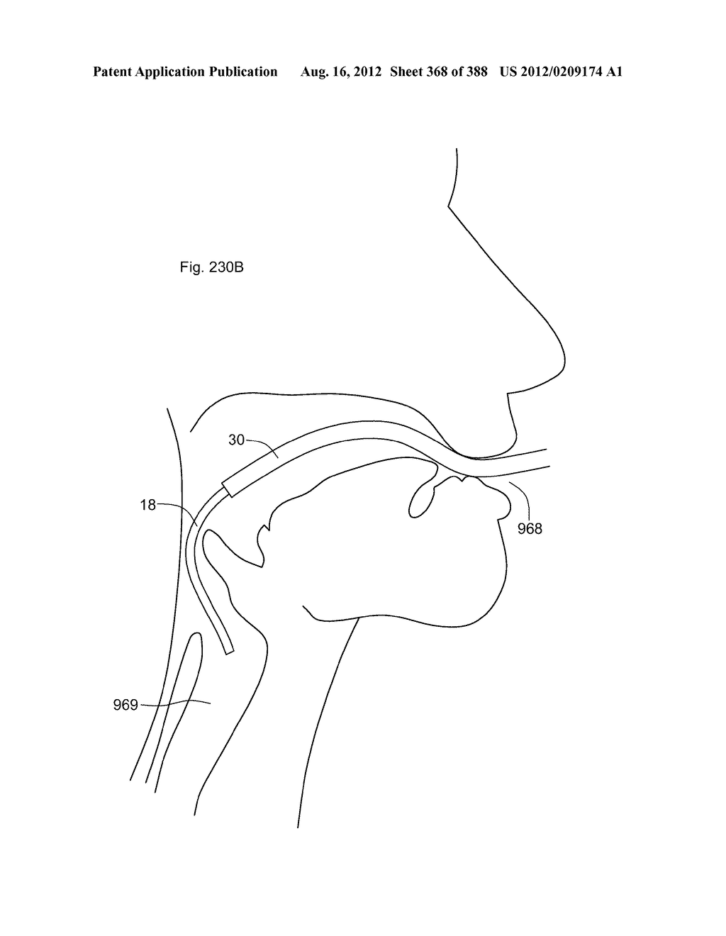 Robotic catheter system and methods - diagram, schematic, and image 369