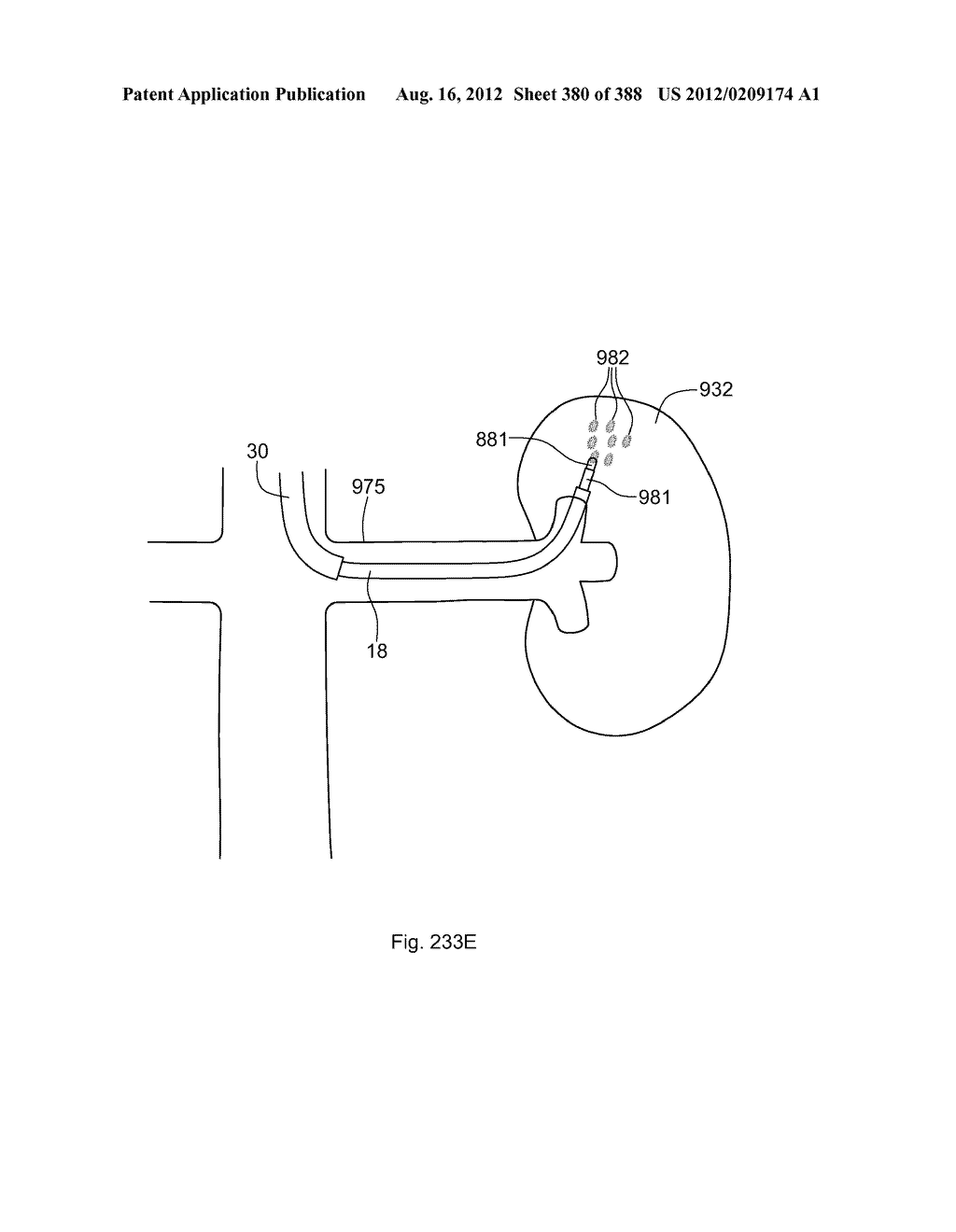 Robotic catheter system and methods - diagram, schematic, and image 381