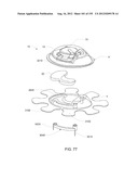 ADHESIVE AND PERIPHERAL SYSTEMS AND METHODS FOR MEDICAL DEVICES diagram and image