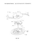 ADHESIVE AND PERIPHERAL SYSTEMS AND METHODS FOR MEDICAL DEVICES diagram and image