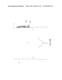 ADHESIVE AND PERIPHERAL SYSTEMS AND METHODS FOR MEDICAL DEVICES diagram and image