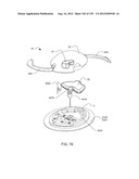 ADHESIVE AND PERIPHERAL SYSTEMS AND METHODS FOR MEDICAL DEVICES diagram and image