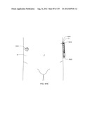 ADHESIVE AND PERIPHERAL SYSTEMS AND METHODS FOR MEDICAL DEVICES diagram and image