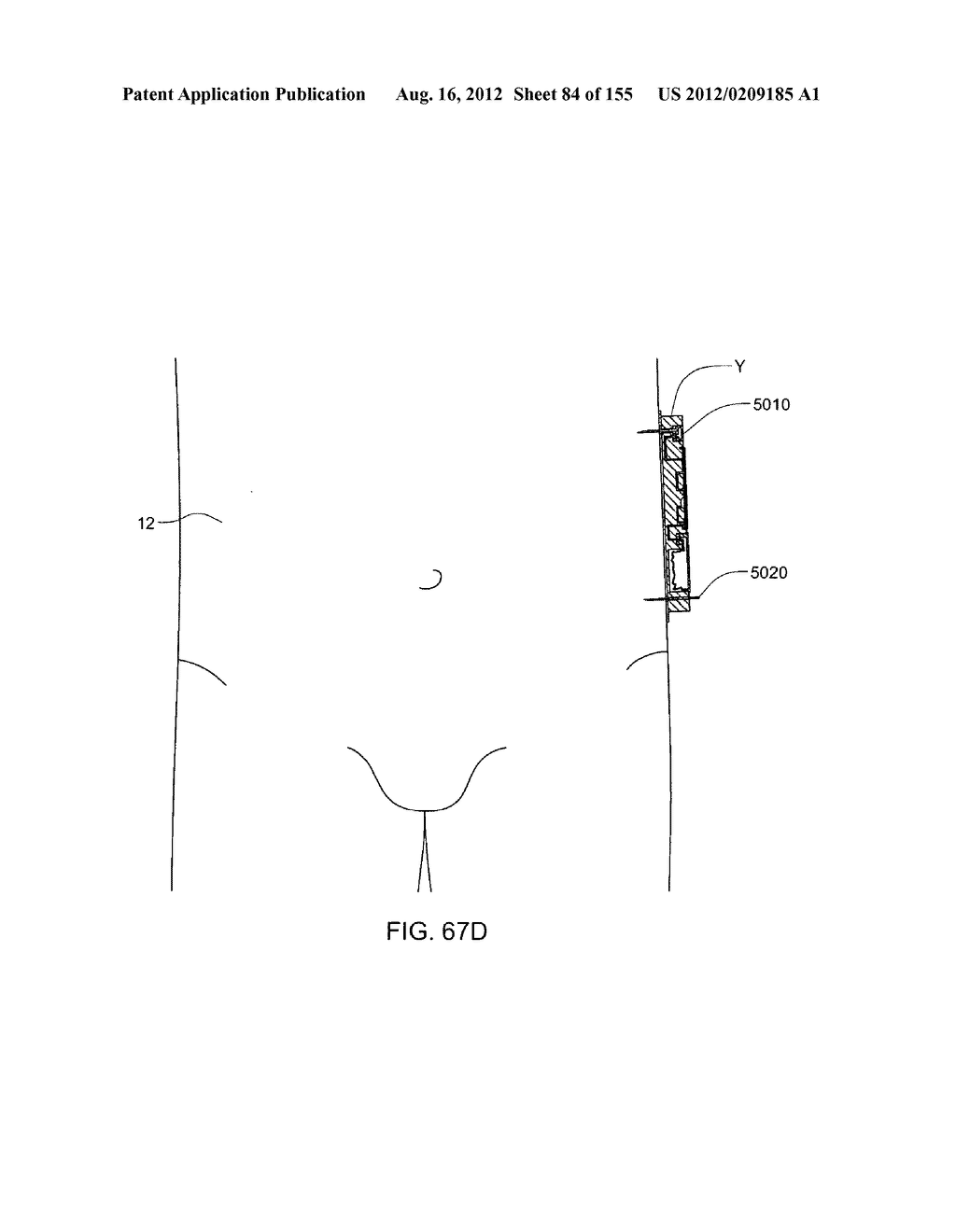 ADHESIVE AND PERIPHERAL SYSTEMS AND METHODS FOR MEDICAL DEVICES - diagram, schematic, and image 85