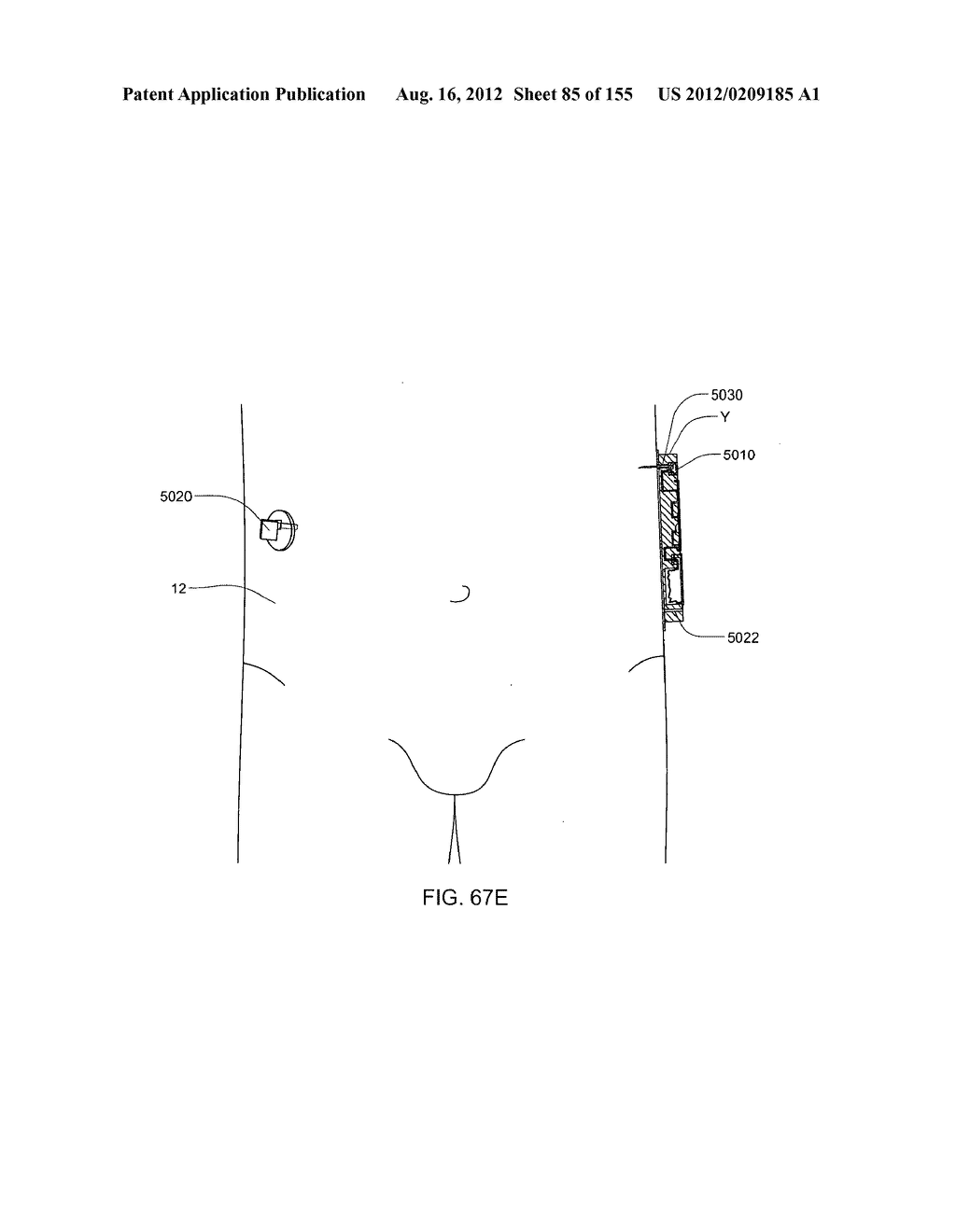 ADHESIVE AND PERIPHERAL SYSTEMS AND METHODS FOR MEDICAL DEVICES - diagram, schematic, and image 86