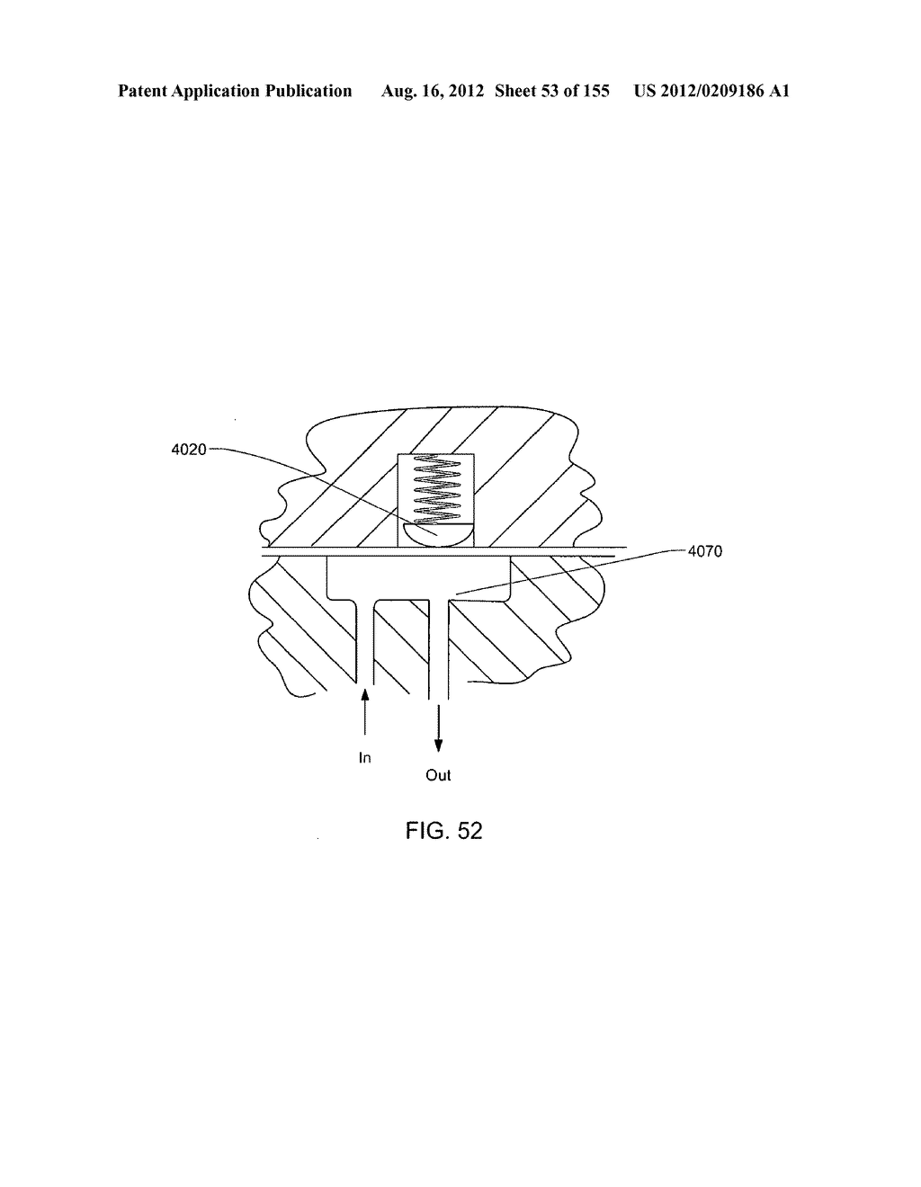 PATCH-SIZED FLUID DELIVERY SYSTEMS AND METHODS - diagram, schematic, and image 54