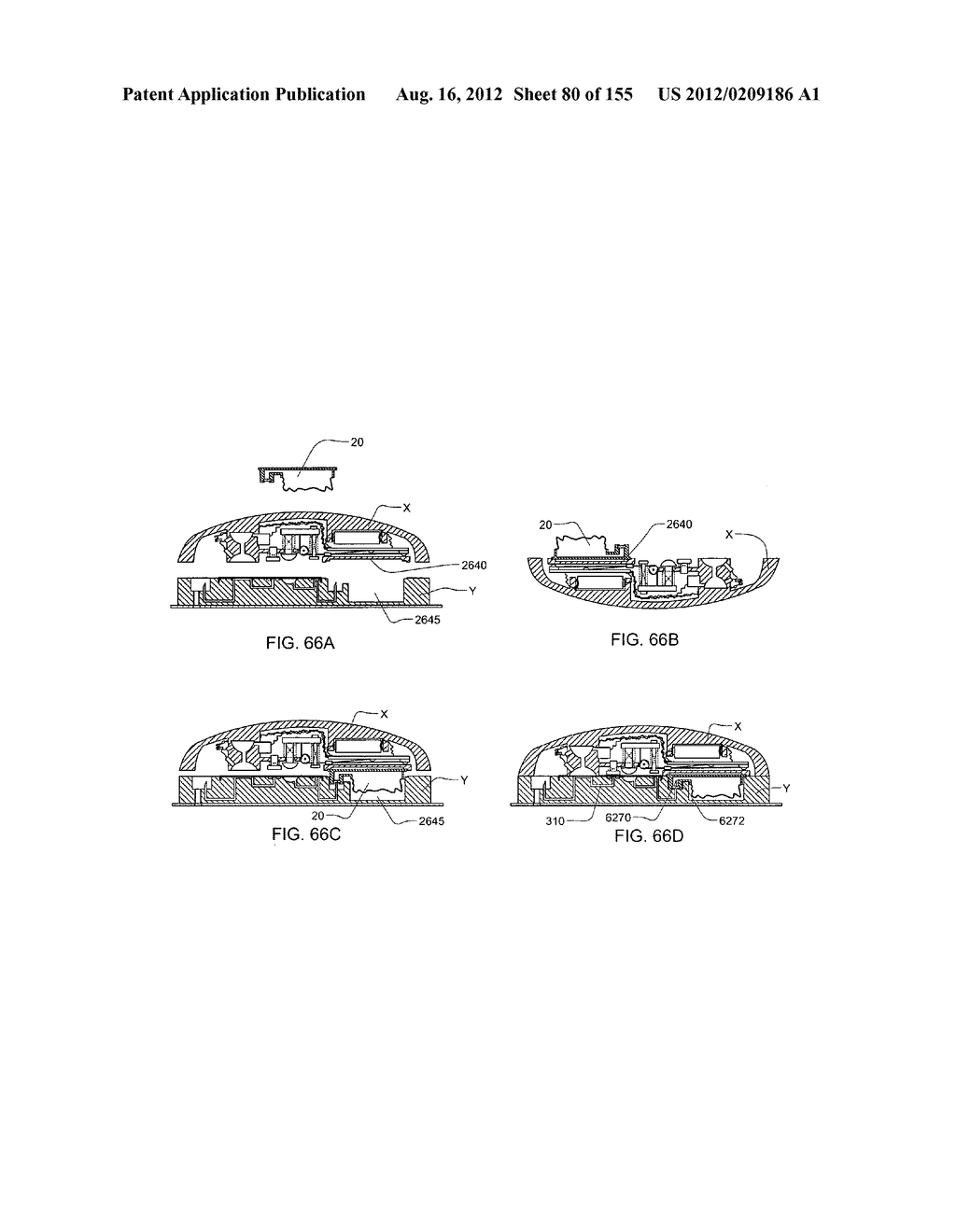 PATCH-SIZED FLUID DELIVERY SYSTEMS AND METHODS - diagram, schematic, and image 81