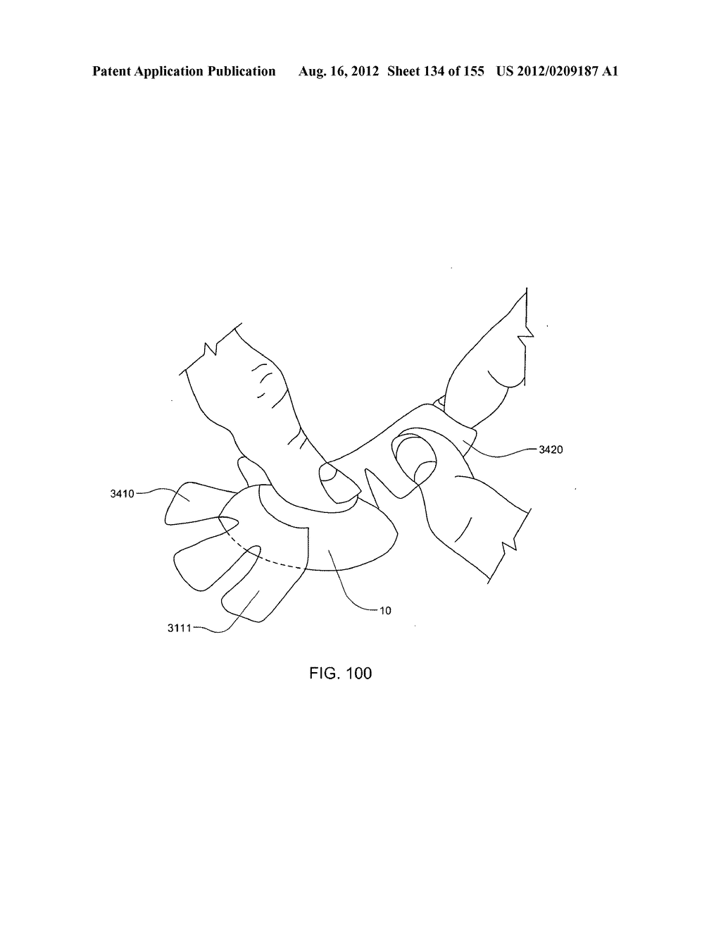 PATCH-SIZED FLUID DELIVERY SYSTEMS AND METHODS - diagram, schematic, and image 135