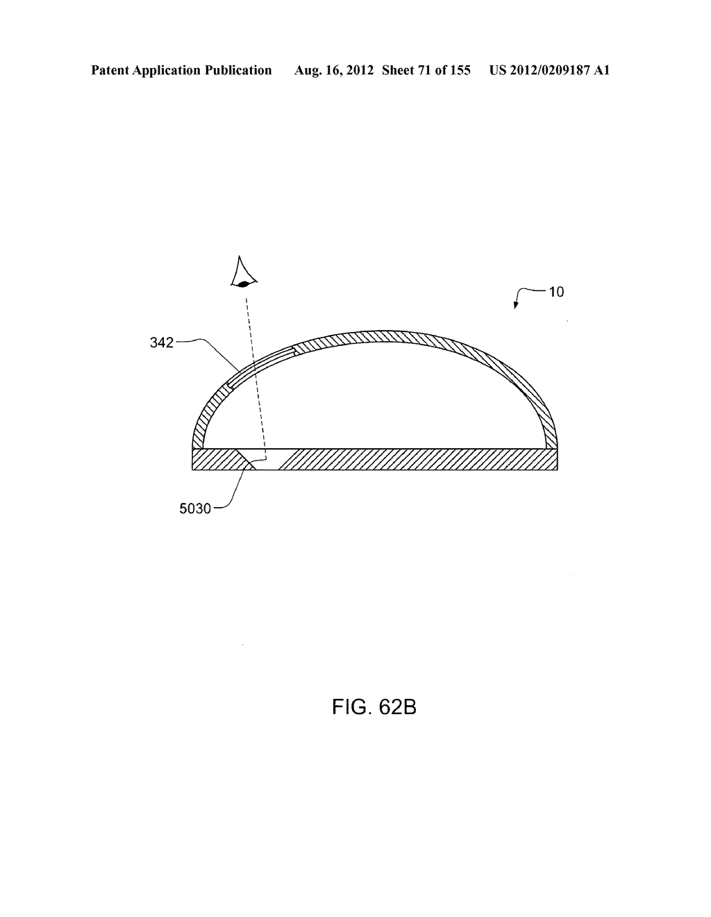 PATCH-SIZED FLUID DELIVERY SYSTEMS AND METHODS - diagram, schematic, and image 72