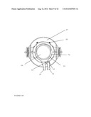 TROCAR STABILITY ASSEMBLY diagram and image