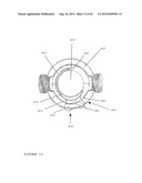 TROCAR STABILITY ASSEMBLY diagram and image