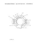 TROCAR STABILITY ASSEMBLY diagram and image