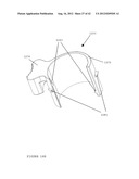 TROCAR STABILITY ASSEMBLY diagram and image