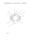 TROCAR STABILITY ASSEMBLY diagram and image