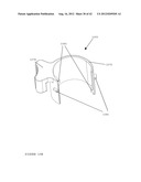 TROCAR STABILITY ASSEMBLY diagram and image