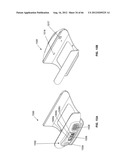 CONTROLLED NEGATIVE PRESSURE APPARATUS AND ALARM MECHANISM diagram and image