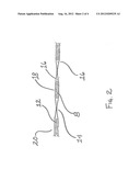 Disposable Absorbent Article Containing An Unapertured Skinless     Elastomeric Layer diagram and image