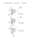 Disposable Absorbent Article Containing An Unapertured Skinless     Elastomeric Layer diagram and image