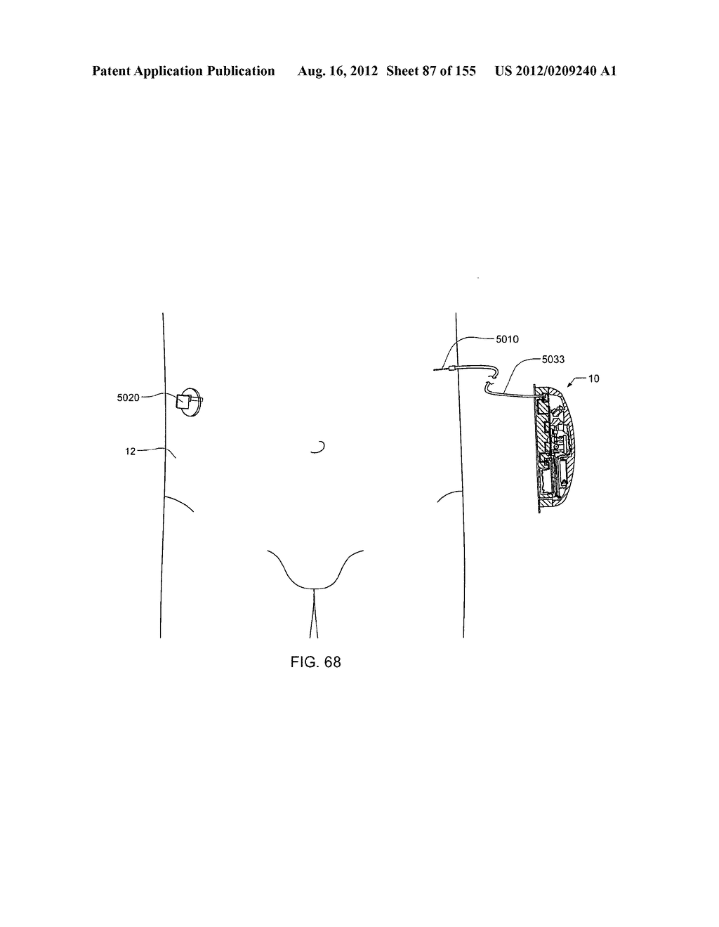 PATCH-SIZED FLUID DELIVERY SYSTEMS AND METHODS - diagram, schematic, and image 88