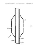 NANOTUBE-REINFORCED BALLOONS FOR DELIVERING THERAPEUTIC AGENTS WITHIN OR     BEYOND THE WALL OF BLOOD VESSELS, AND METHODS OF MAKING AND USING SAME diagram and image