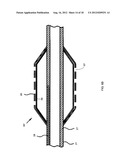 NANOTUBE-REINFORCED BALLOONS FOR DELIVERING THERAPEUTIC AGENTS WITHIN OR     BEYOND THE WALL OF BLOOD VESSELS, AND METHODS OF MAKING AND USING SAME diagram and image