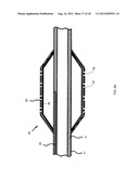 NANOTUBE-REINFORCED BALLOONS FOR DELIVERING THERAPEUTIC AGENTS WITHIN OR     BEYOND THE WALL OF BLOOD VESSELS, AND METHODS OF MAKING AND USING SAME diagram and image