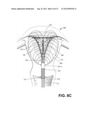 SYSTEMS AND METHODS FOR ENDOMETRIAL ABLATION diagram and image